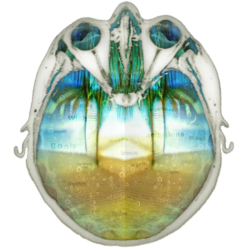 MRI scan of brain with beach scenery in the middle
